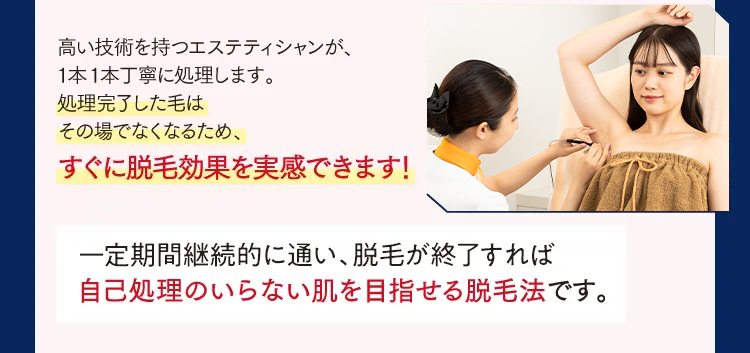 2 終わりのある＊脱毛