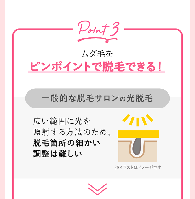 ムダ毛をピンポイントで脱毛できる！