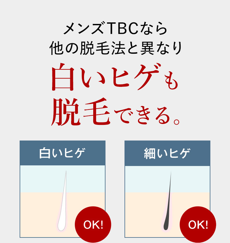メンズTBCなら
他の脱毛法と異なり
白いヒゲも
脱毛できる。
白いヒゲ
細いヒゲ
OK!
OK!