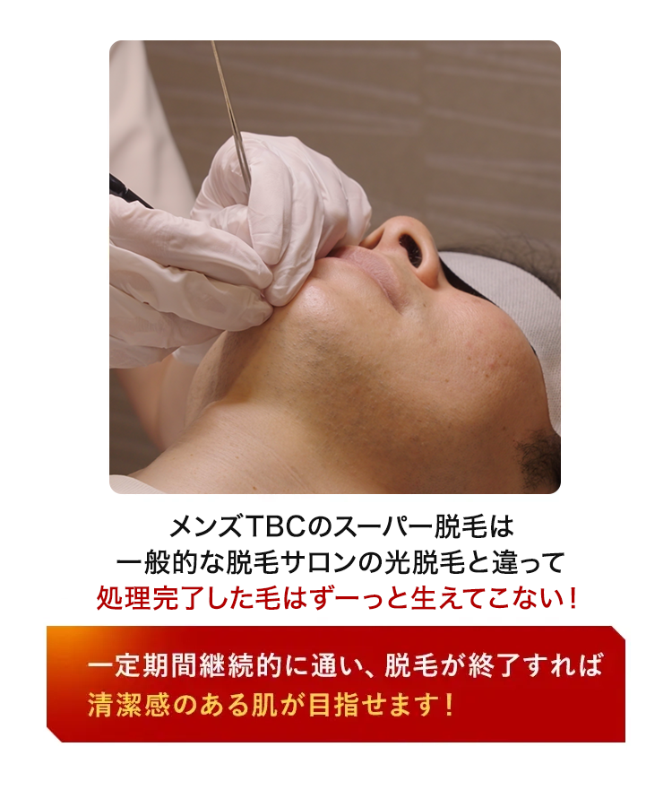 メンズTBCのスーパー脱毛は
一般的な脱毛サロンの光脱毛と違って
処理完了した毛はずーっと生えてこない!
一定期間継続的に通い、 脱毛が終了すれば
清潔感のある肌が目指せます!