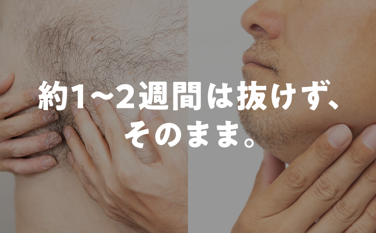 約1~2週間は抜けず、
そのまま。