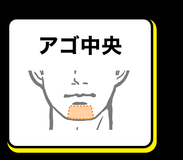 アゴ中央