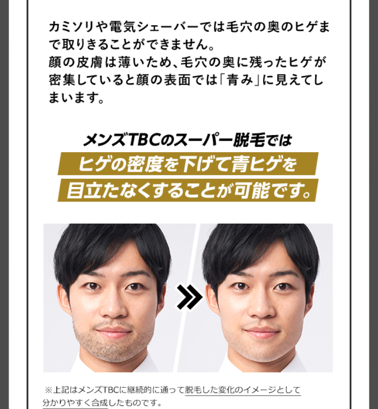 青ヒゲの原因