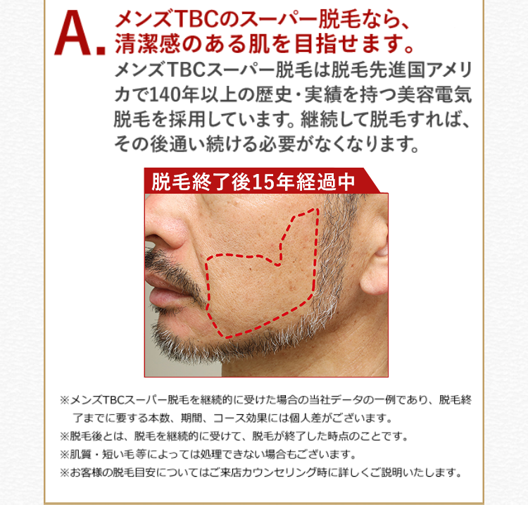 メンズTBCのスーパー脱毛なら、清潔感のある肌を目指せます。
