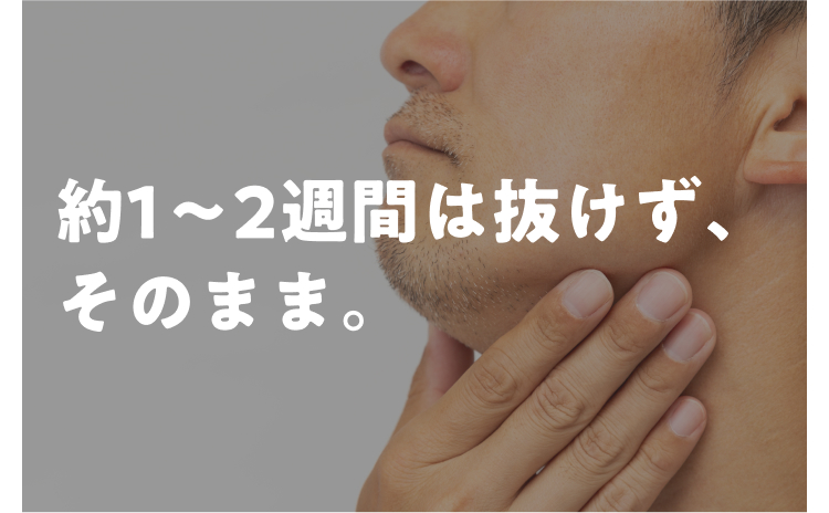 約1~2週間は抜けず、
そのまま。