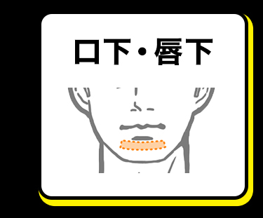 口下・唇下