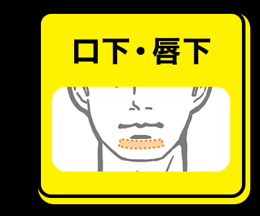 口下・唇下