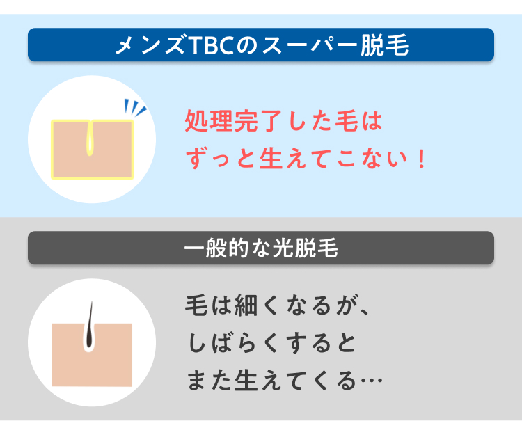 メンズTBCのスーパー脱毛
処理完了した毛は
ずっと生えてこない!
一般的な光脱毛
毛は細くなるが、
しばらくすると
また生えてくる･･･