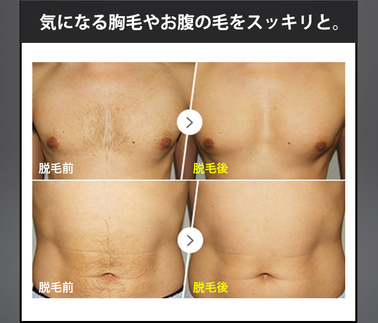 気になる胸毛やお腹の毛をスッキリと。