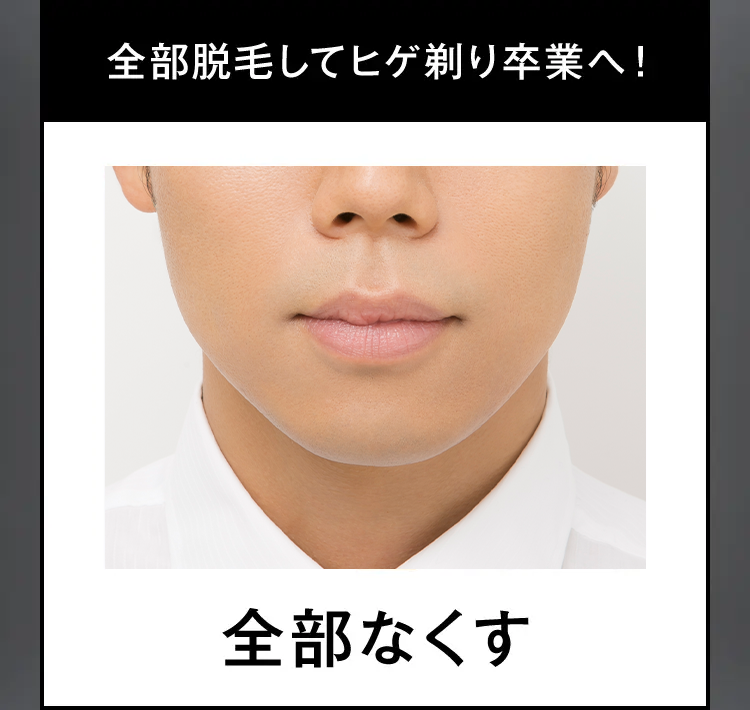 全部脱毛してヒゲ剃り卒業へ!
全部なくす
