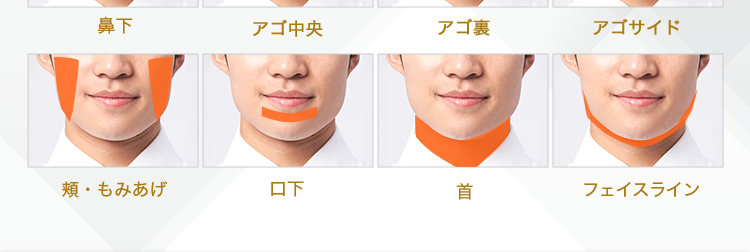 いらない毛だけ脱毛!
MEN'S
TBC
処理完了した毛はずーっと
生えてこない!
鼻下
アゴ中央
アゴ裏
アゴサイド
頬・もみあげ
口下
首
フェイスライン