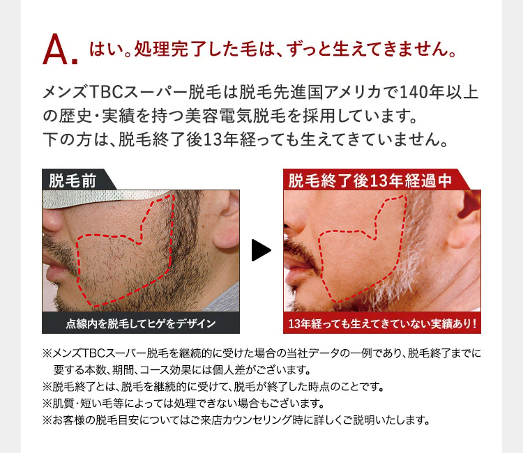 はい。処理完了した毛は、ずっと生えてきません。